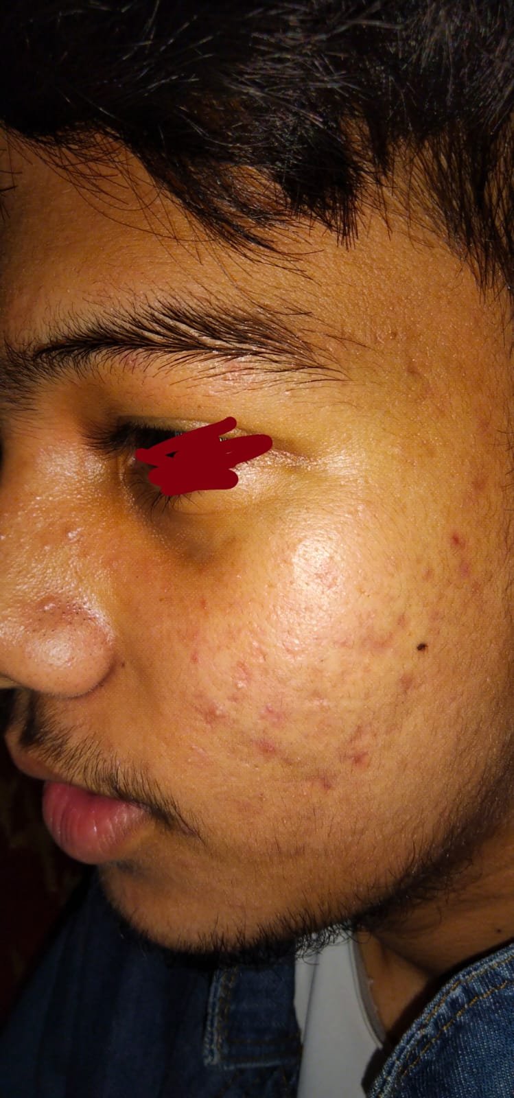 Before Face